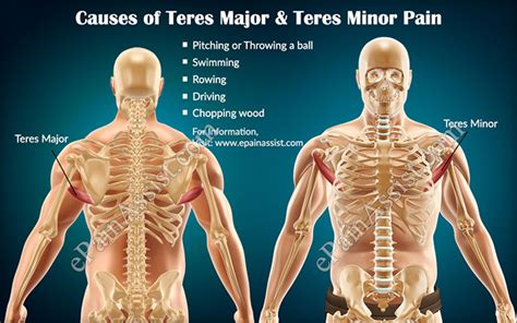 Teres Major Muscle Pain: Symptoms, Causes & Treatment