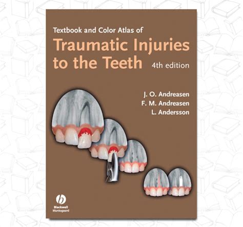 Textbook and Color Atlas of Traumatic Injuries to the Teeth 4th Edition PDF