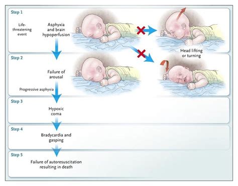 The "Discovery" of Sudden Infant Death Syndrome Lessons in Reader