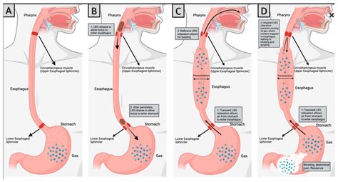 The Anatomy of the RCPD