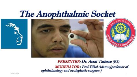 The Anophthalmic Socket International Edition PDF