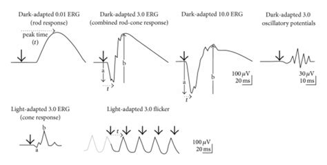 The Basics of Ergs Per Second