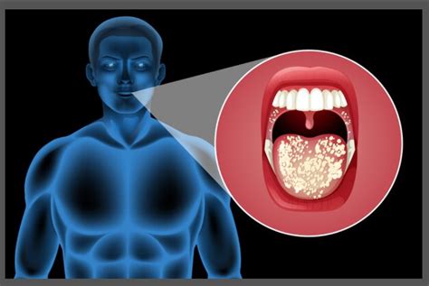 The BecktheTongue Technique: A Comprehensive Guide to Improving Oral Health