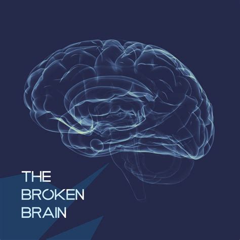 The Broken Brain Reader