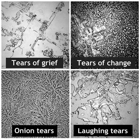 The Composition and Formation of Tear Crystals