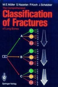 The Comprehensive Classification of Fractures of Long Bones The Complete Illustrated Guide to Aroma Kindle Editon