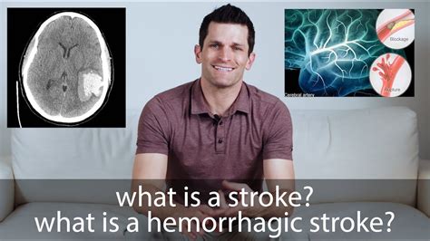 The Comprehensive Guide to Understanding Stroke: Everything You Need to Know About Risk Factors, Symptoms, and Recovery