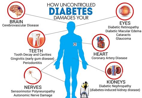 The Dangers of Diabetes Epub