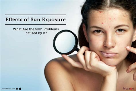 The Devastating Impact of Sun Exposure