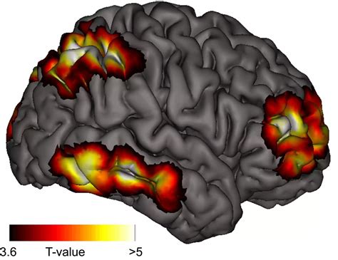 The Dreaming Brain Epub