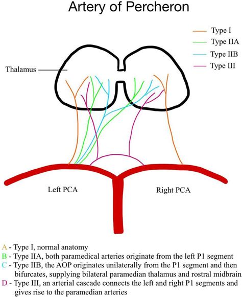 The Effects of Percharunt