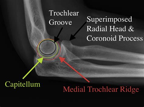 The Elbow and Its Disorders Epub