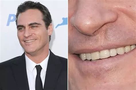 The Enigma of Joaquin Phoenix's Lip Scar