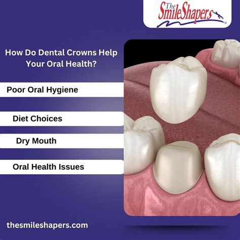 The Essential Guide to Royce Dental Surgery: Enhancing Your Oral Health and Smile