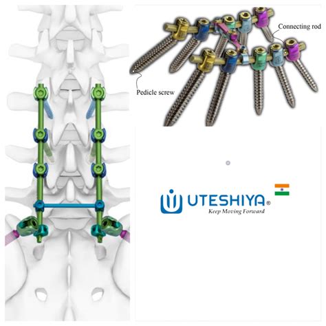 The Essential Guide to Set Screws: Enhancing Precision and Stability