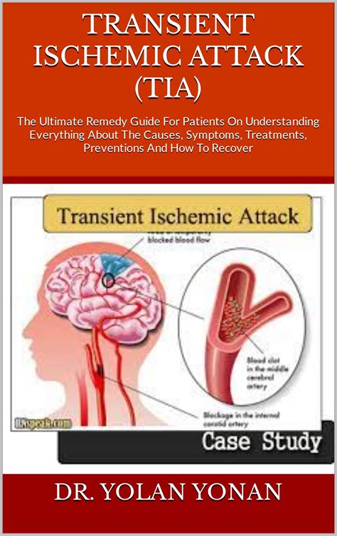 The Evanita: A Comprehensive Guide to Transient Ischemic Attack (TIA)