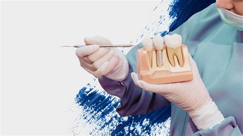 The Financial Impact of Dental Fillings