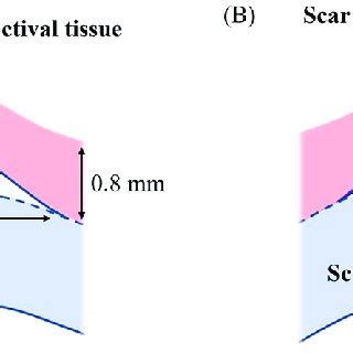 The Geometry of Filtering Doc