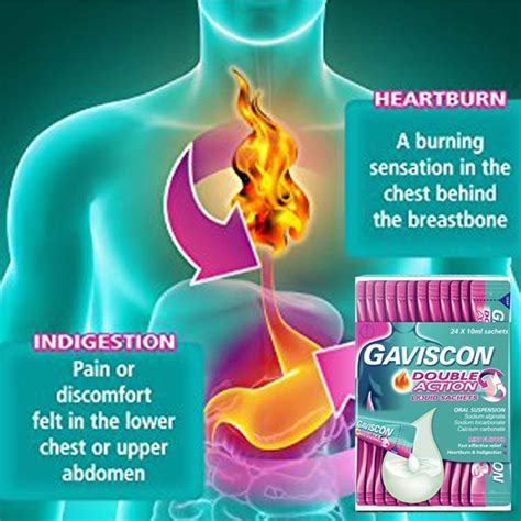 The Heartburn and Indigestion Solution PDF