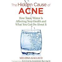 The Hidden Cause of Acne How Toxic Water Is Affecting Your Health and What You Can Do about It Kindle Editon