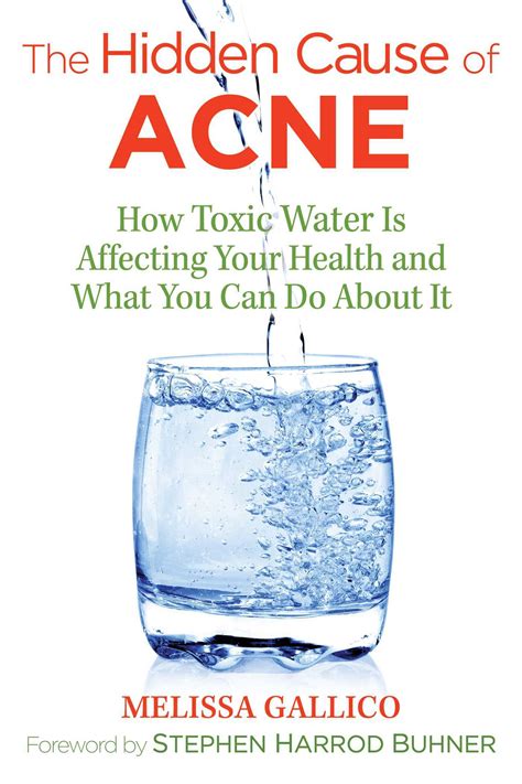 The Hidden Cause of Acne How Toxic Water Is Affecting Your Health and What You Can Do about It Kindle Editon