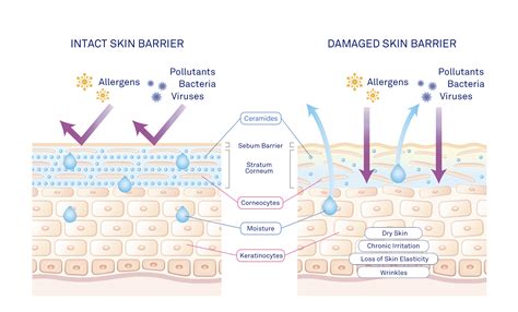 The LBSSQIN to BAR: A Comprehensive Guide to Enhancing Skin Barrier Health