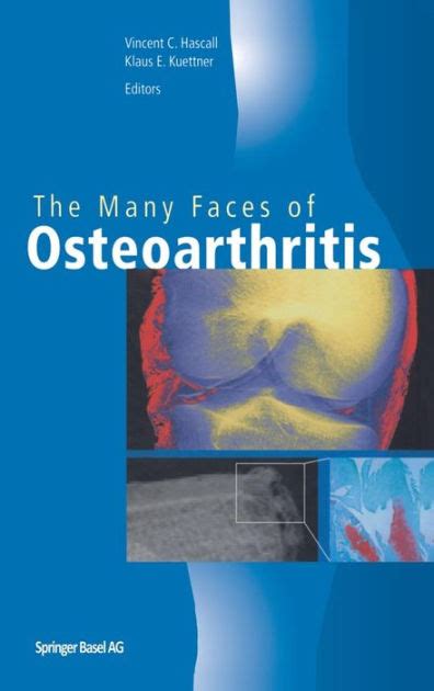 The Many Faces of Osteoarthritis Reader