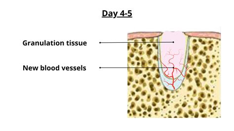 The Pain Points of Granulation