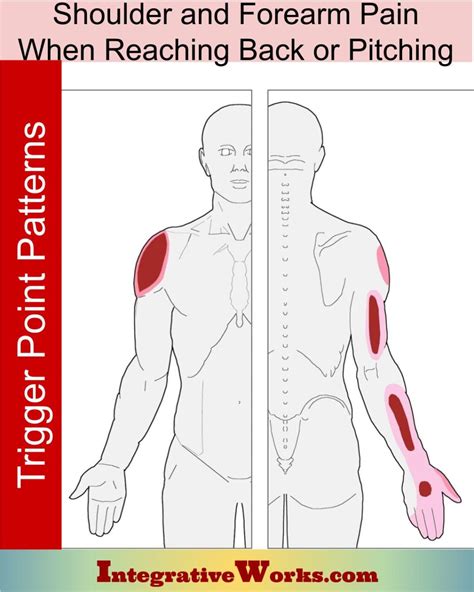 The Pain Points of Pitching