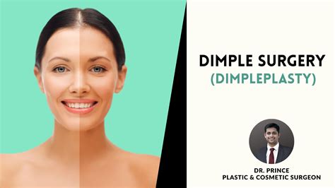 The Playful Charm of Dimples: A Comprehensive Guide to Enhancing Facial Aesthetics