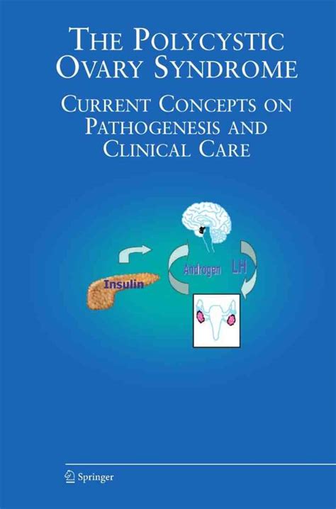 The Polycystic Ovary Syndrome Current Concepts on Pathogenesis and Clinical Care 1st Edition Kindle Editon