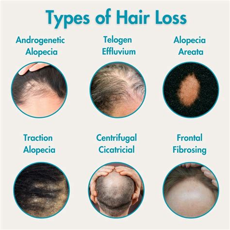 The Problem: Hair Loss and Its Impact