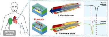 The SmartStent: