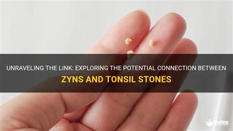 The Sour Truth: Exploring the Disastrous Depths of Zyns