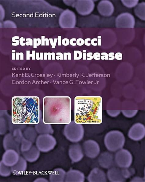 The Staphylococci in Human Disease 1st Edition Doc