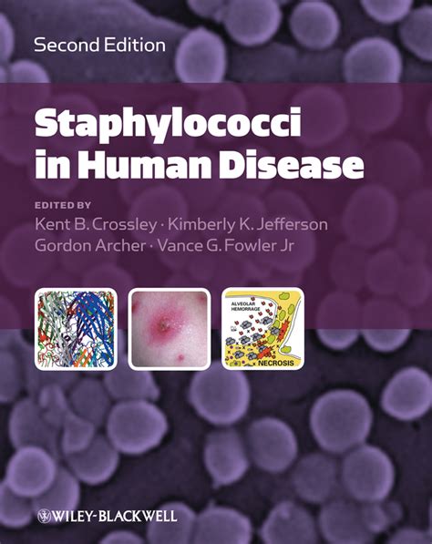 The Staphylococci in Human Disease 1st Edition Doc