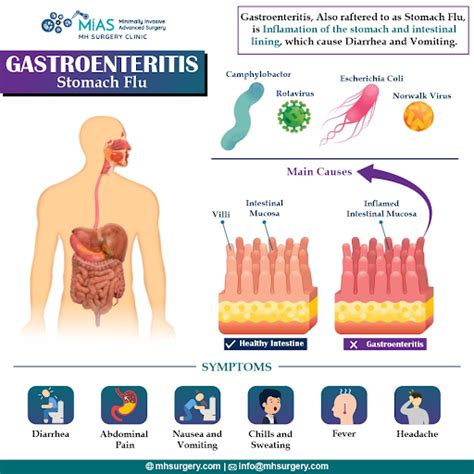 The Ultimate Guide to Acute Gastroenteritis: An Essential Guide for Healthcare Professionals