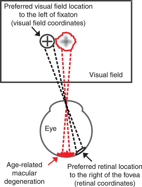 The Ultimate Guide to Eccentric Eye Circles: Dive into the Whimsical World of Under-Eye Delights