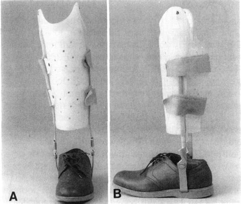 The Ultimate Guide to Master Patella Tendon Bearing: Embracing the Journey to Comfort