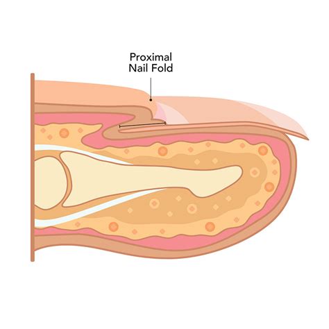 The proximal nail quick: