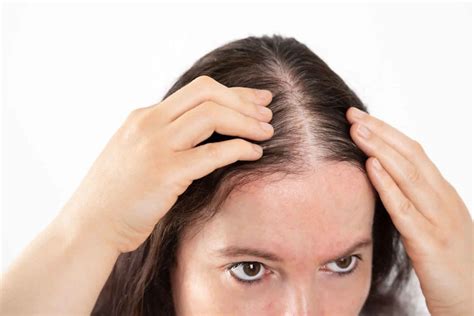 Thin Hair or Hair Loss: