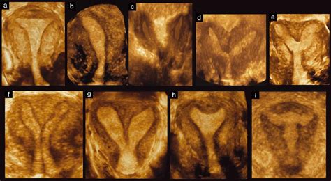 Three-Dimensional Ultrasound Doc