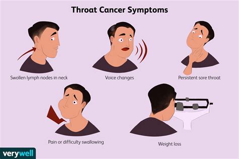 Throat Cancer: Know the Signs and Symptoms to Protect Your Voice