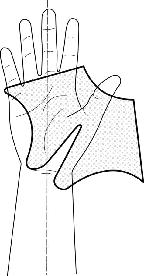 Thumb Spica Template