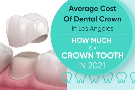 Tooth Crown Cost Without Insurance: Breaking Down the Numbers