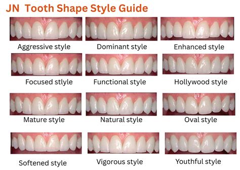 Tooth Shape Chart