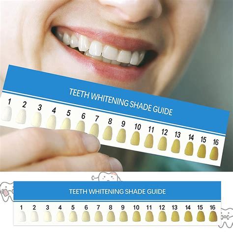 Tooth Whiteness Chart