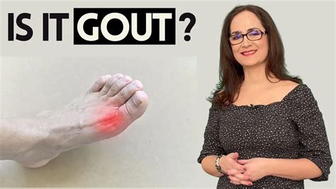 Top 5 Causes of Gout in 2023: What You Need to Know