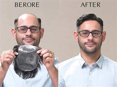 Toupee for Men: The 5000-Year-Old Solution for Hair Loss