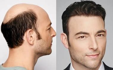 Toupees for Men: Escape the Baldness Blues with These 50+ Hair-Raising Options